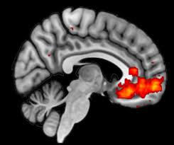 MRI-scan van het menselijk brein (fMRI)
